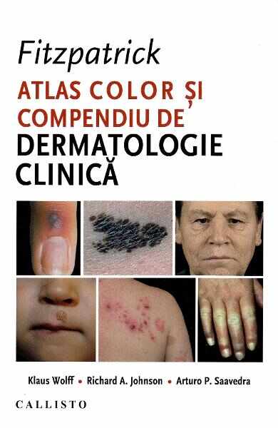 Fitzpatrick. Atlas color si compendiu de dermatologie clinica - Klaus Wolff