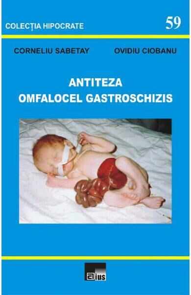Antiteza omfalocel gastroschizis - Corneliu Sabetay, Ovidiu Ciobanu