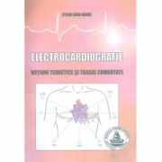 Electrocardiografie - Stefan Arama