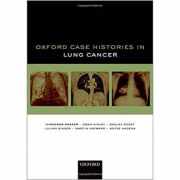 Oxford Case Histories in Lung Cancer - Himender K. Makker, Adam Ainley, Sanjay Popat, Julian Singer, Martin Hayward, Antke Hagena